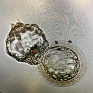 hatching blastocyst