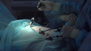 Minimally invasive gynecologic surgery