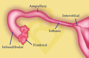 fallopian tube anatomy