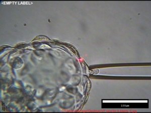 Embryo biopsy under microscope