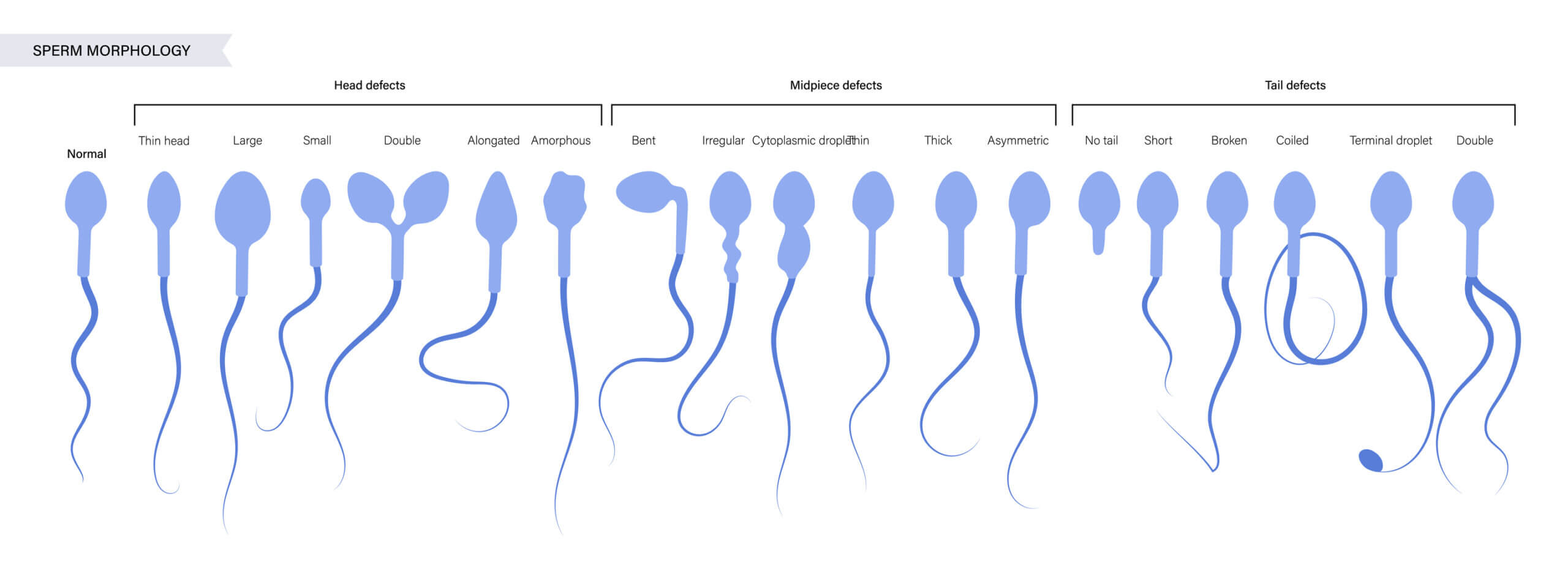Sperm morphology defects