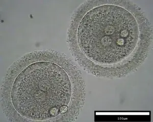 What happens to your embryos in the IVF lab?