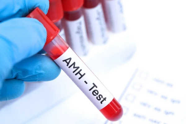 Interpreting AMH test results